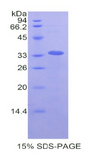 LOXL4 / LOXC Protein - Recombinant Lysyl Oxidase Like Protein 4 By SDS-PAGE