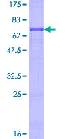 LP-PLA2 / PLA2G7 Protein - 12.5% SDS-PAGE of human PLA2G7 stained with Coomassie Blue