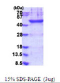 LP-PLA2 / PLA2G7 Protein