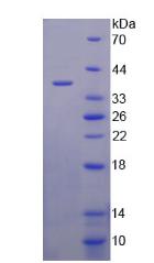 LPA / Lipoprotein a Protein - Recombinant  Lipoprotein, a By SDS-PAGE