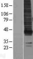 LPAR1 / LPA1 / EDG2 Protein - Western validation with an anti-DDK antibody * L: Control HEK293 lysate R: Over-expression lysate