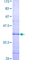 LPAR1 / LPA1 / EDG2 Protein - 12.5% SDS-PAGE Stained with Coomassie Blue.