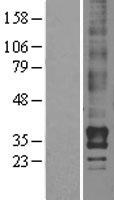 LPAR2 / EDG4 Protein - Western validation with an anti-DDK antibody * L: Control HEK293 lysate R: Over-expression lysate