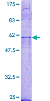 LPAR2 / EDG4 Protein - 12.5% SDS-PAGE of human EDG4 stained with Coomassie Blue