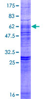 LPAR3 / LPA3 / EDG7 Protein - 12.5% SDS-PAGE of human EDG7 stained with Coomassie Blue