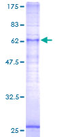 LPAR5 / GPR92 Protein - 12.5% SDS-PAGE of human GPR92 stained with Coomassie Blue