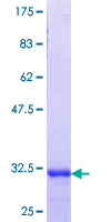 LPAR5 / GPR92 Protein - 12.5% SDS-PAGE Stained with Coomassie Blue