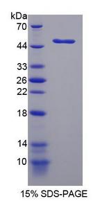 LPCAT1 / AYTL2 Protein - Recombinant Lysophosphatidylcholine Acyltransferase 1 By SDS-PAGE