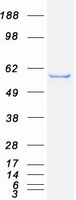 LPCAT1 / AYTL2 Protein - Purified recombinant protein LPCAT1 was analyzed by SDS-PAGE gel and Coomassie Blue Staining