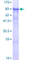 LPCAT2 Protein - 12.5% SDS-PAGE of human LPCAT2 stained with Coomassie Blue