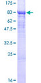 LPCAT2 Protein - 12.5% SDS-PAGE of human LPCAT2 stained with Coomassie Blue
