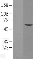 LPCAT4 Protein - Western validation with an anti-DDK antibody * L: Control HEK293 lysate R: Over-expression lysate