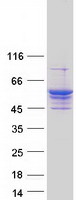 LPCAT4 Protein - Purified recombinant protein LPCAT4 was analyzed by SDS-PAGE gel and Coomassie Blue Staining
