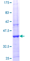 LPIN1 / Lipin 1 Protein - 12.5% SDS-PAGE Stained with Coomassie Blue.