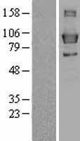 LPIN3 / Lipin-3 Protein - Western validation with an anti-DDK antibody * L: Control HEK293 lysate R: Over-expression lysate