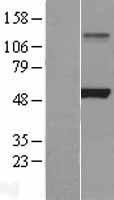 LPL / Lipoprotein Lipase Protein - Western validation with an anti-DDK antibody * L: Control HEK293 lysate R: Over-expression lysate