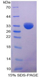 LPL / Lipoprotein Lipase Protein - Recombinant Lipase, Lipoprotein By SDS-PAGE