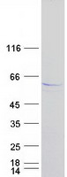 LPL / Lipoprotein Lipase Protein - Purified recombinant protein LPL was analyzed by SDS-PAGE gel and Coomassie Blue Staining