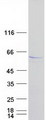 LPL / Lipoprotein Lipase Protein - Purified recombinant protein LPL was analyzed by SDS-PAGE gel and Coomassie Blue Staining