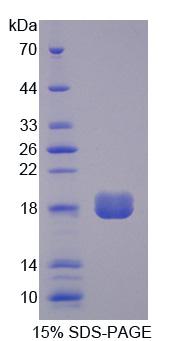 LPP3 / PPAP2B Protein - Recombinant Phosphatidic Acid Phosphatase Type 2B (PPAP2B) by SDS-PAGE