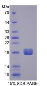 LPP3 / PPAP2B Protein - Recombinant Phosphatidic Acid Phosphatase Type 2B (PPAP2B) by SDS-PAGE