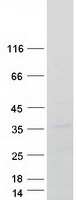 LPP3 / PPAP2B Protein - Purified recombinant protein PLPP3 was analyzed by SDS-PAGE gel and Coomassie Blue Staining