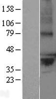 LPPR2 Protein - Western validation with an anti-DDK antibody * L: Control HEK293 lysate R: Over-expression lysate