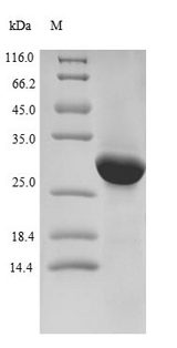 LPPR2 Protein - (Tris-Glycine gel) Discontinuous SDS-PAGE (reduced) with 5% enrichment gel and 15% separation gel.