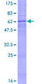 LPPR2 Protein - 12.5% SDS-PAGE of human LPPR2 stained with Coomassie Blue