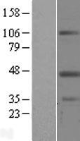 LPXN / Leupaxin Protein - Western validation with an anti-DDK antibody * L: Control HEK293 lysate R: Over-expression lysate