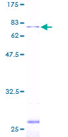 LPXN / Leupaxin Protein - 12.5% SDS-PAGE of human LPXN stained with Coomassie Blue