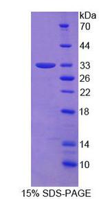 LPXN / Leupaxin Protein - Recombinant Leupaxin (LPXN) by SDS-PAGE