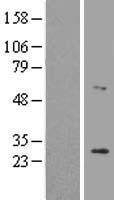 LRAT Protein - Western validation with an anti-DDK antibody * L: Control HEK293 lysate R: Over-expression lysate