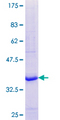 LRAT Protein - 12.5% SDS-PAGE Stained with Coomassie Blue.
