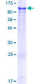 LRCH3 Protein - 12.5% SDS-PAGE of human LRCH3 stained with Coomassie Blue