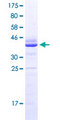 LRCH4 Protein - 12.5% SDS-PAGE Stained with Coomassie Blue.