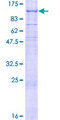 LRFN1 Protein - 12.5% SDS-PAGE of human LRFN1 stained with Coomassie Blue