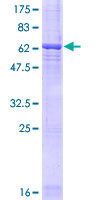LRG1 / LRG Protein - 12.5% SDS-PAGE of human LRG1 stained with Coomassie Blue