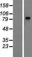 LRGUK Protein - Western validation with an anti-DDK antibody * L: Control HEK293 lysate R: Over-expression lysate