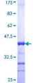 LRGUK Protein - 12.5% SDS-PAGE Stained with Coomassie Blue.