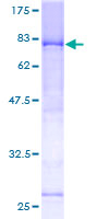 LRIF1 / RIF1 Protein - 12.5% SDS-PAGE of human C1orf103 stained with Coomassie Blue