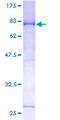 LRIF1 / RIF1 Protein - 12.5% SDS-PAGE of human C1orf103 stained with Coomassie Blue