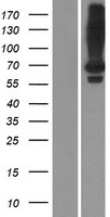 LRIT2 Protein - Western validation with an anti-DDK antibody * L: Control HEK293 lysate R: Over-expression lysate