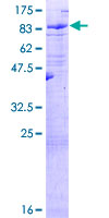 LRIT3 Protein - 12.5% SDS-PAGE of human LRIT3 stained with Coomassie Blue