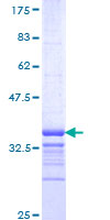 LRIT3 Protein - 12.5% SDS-PAGE Stained with Coomassie Blue