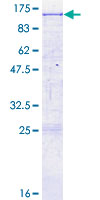 LRP10 Protein - 12.5% SDS-PAGE of human LRP10 stained with Coomassie Blue