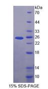 LRP2 / Megalin Protein - Recombinant Low Density Lipoprotein Receptor Related Protein 2 By SDS-PAGE