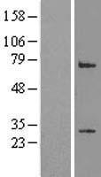 LRP2BP / LRP2 Binding Protein Protein - Western validation with an anti-DDK antibody * L: Control HEK293 lysate R: Over-expression lysate
