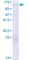 LRP3 Protein - 12.5% SDS-PAGE of human LRP3 stained with Coomassie Blue