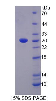 LRP3 Protein - Recombinant Low Density Lipoprotein Receptor Related Protein 3 By SDS-PAGE